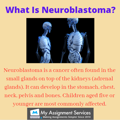What Is Neuroblastoma?