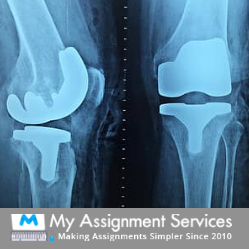Orthopedic Assignment Help