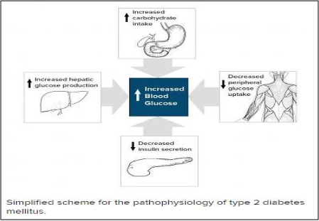 Pathophysiology of type 2 diabetes mellitus 